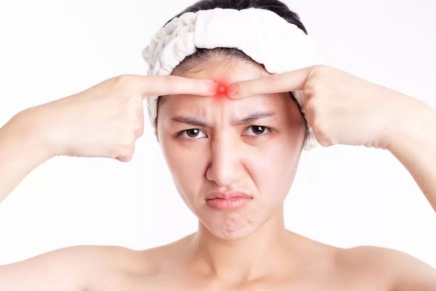 Minh họa mụn vùng chữ T trên da