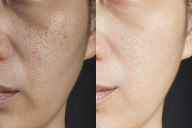 Bộ đôi cải thiện da xỉn màu tối ưu