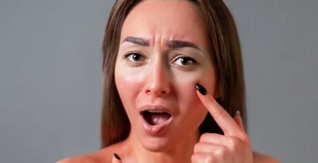 Da xỉn màu, đỏ sau khi tiếp xúc thời gian dài với ánh nắng