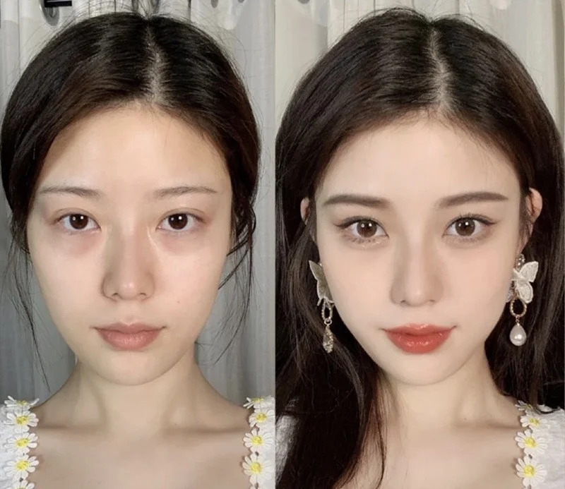 Hình: Cải thiện quầng thâm, nếp nhăn để có diện mạo đẹp hơn