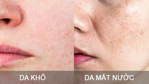 da dầu thiếu nước