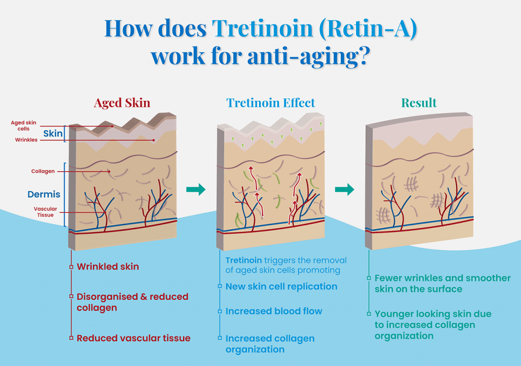 obagi-chia-se-nhung-dieu-can-biet-ve-tretinoin