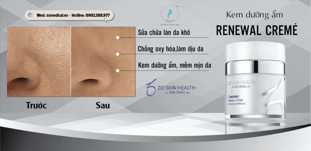 Công dụng kem dưỡng ẩm RENEWAL CREMÉ