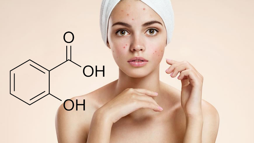 Salicylic Acid Tiên dược dành cho da dầu và da mụn [Phần 4] - Blog làm đẹp