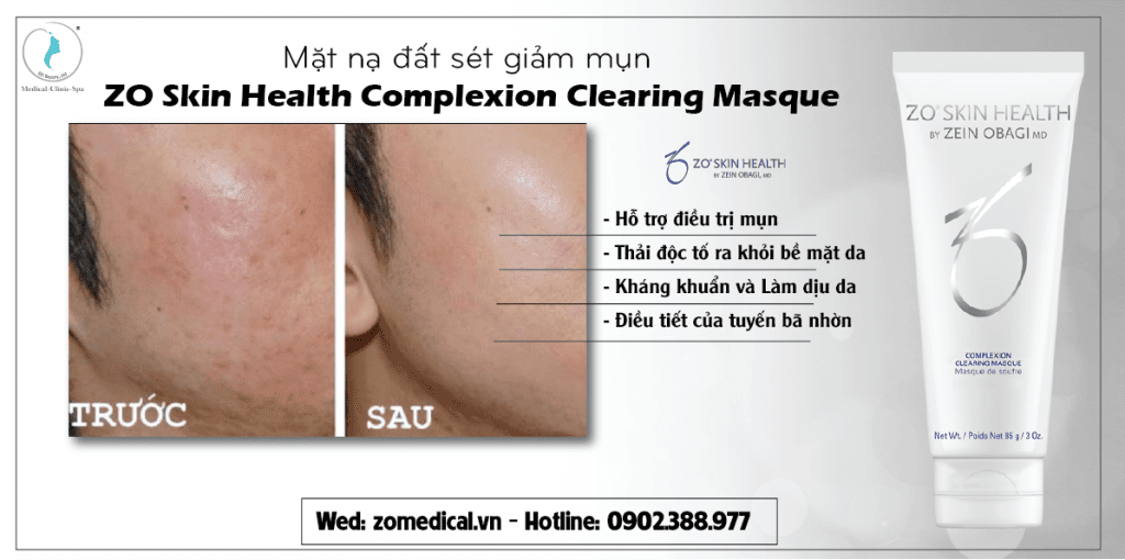 Công dụng của mặt nạ đất sét giảm mụn ZO Skin Health Complexion Clearing Masque