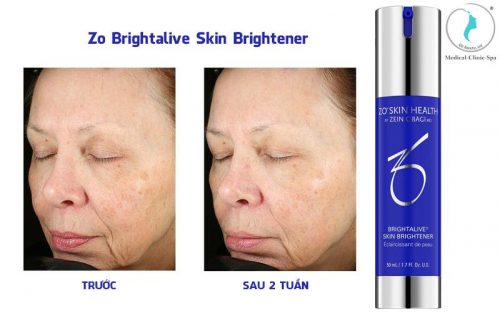 Hiệu quả sau 2 tuần khi sử dụng dưỡng trắng Zo Brightalive Skin Brightener