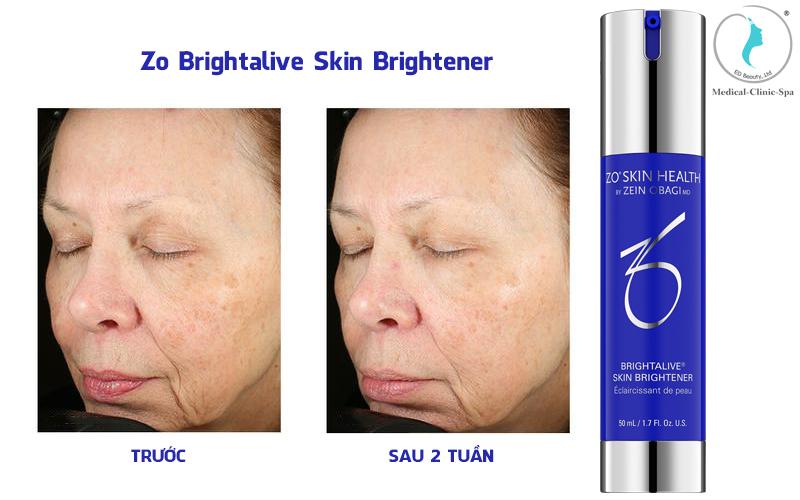 ZO BRIGHTALIVE SKIN BRIGHTENER VỚI CÔNG THỨC DƯỠNG TRẮNG DA VƯỢT TRỘI