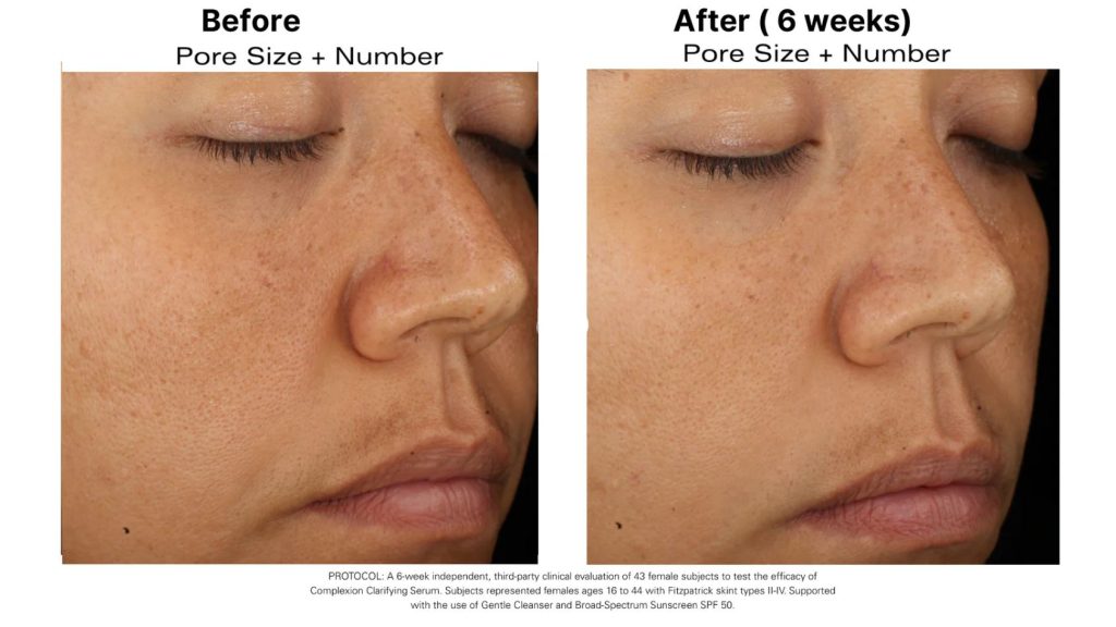 Kết quả nhìn thấy được khi sử dụng COMPLEXION CLARIFYING SERUM
