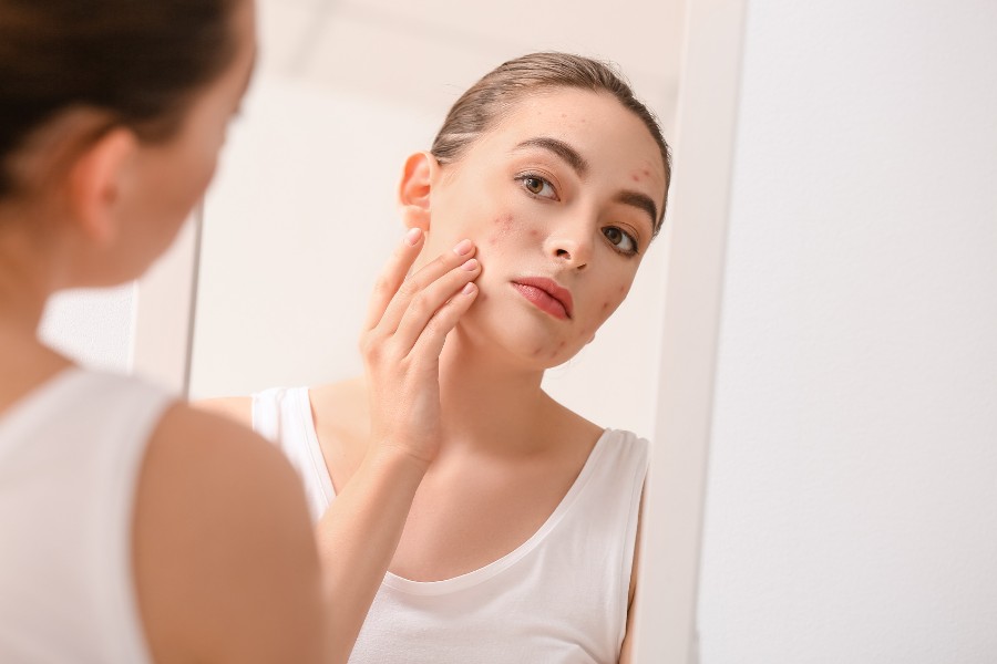 Tuân thủ quy trình này sẽ giúp bạn giữ làn da khỏe mạnh, giảm dầu nhờn