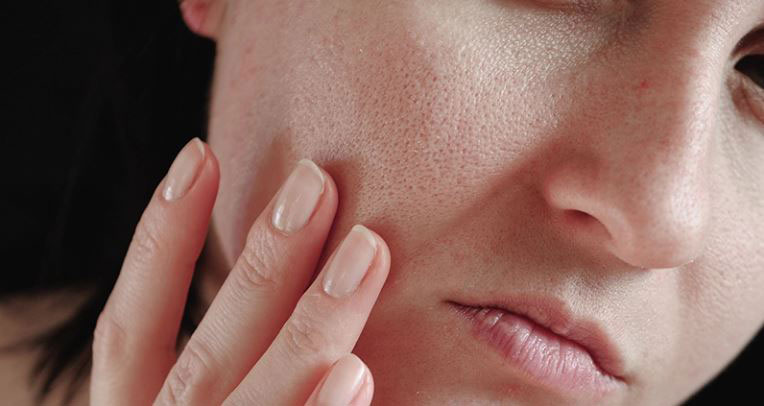 4 Bước Chăm Sóc Da Mùa Lạnh