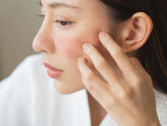 Hình: Da "xuống phong độ" vào dip cận tết