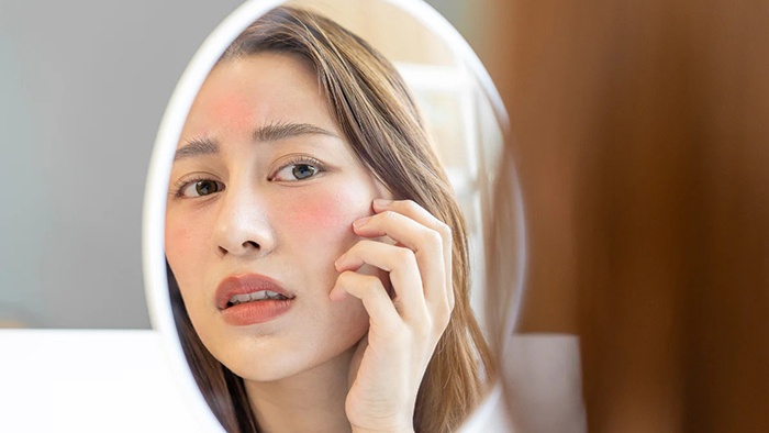 Hình: Không củng cố hàng rào bảo vệ da